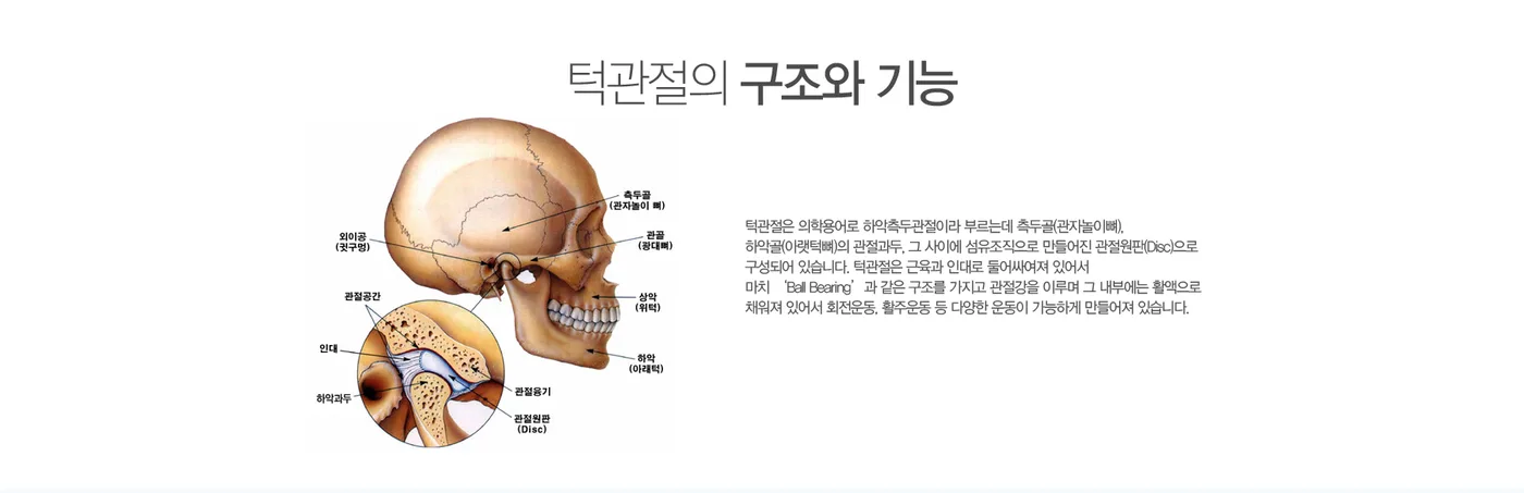 턱관절의 구조 도해 — 측두골, 하악골 관절과두, 관절원판(디스크)의 위치